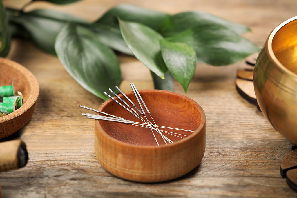 Bowl with acupuncture needles on wooden table, Traditional Chinese Medicine. Photo by Shutterstock